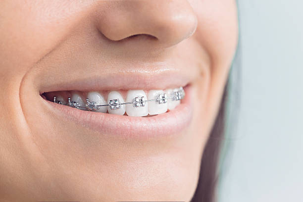 Best Veneers and Lumineers  in Aberdeen Proving Ground, MD